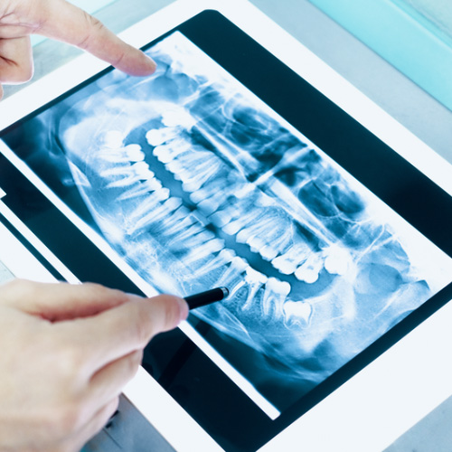 Grafica de paste de dientes compuesta por palabras de ingredientes