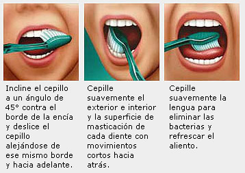 buena higiene oral