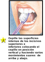cepillo correcto