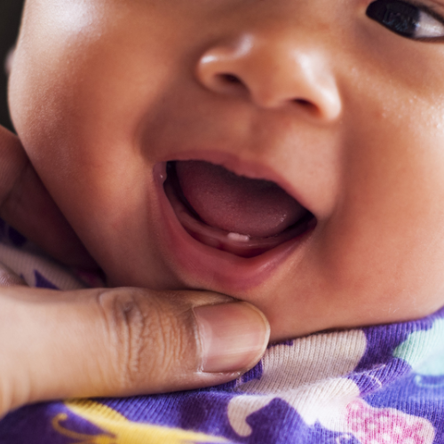 Bebé sonriendo mostrando sus primeros dientes.