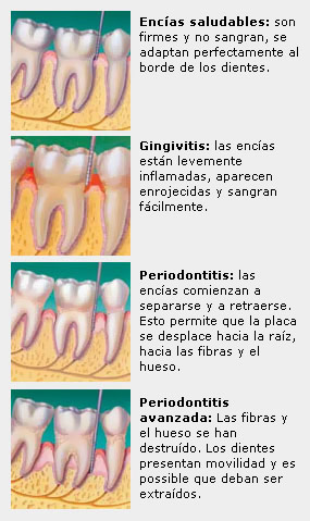 Infografia del estado de los dientes